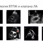 Диагностика врожденных пороков сердца