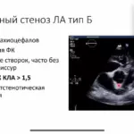 Диагностика врожденных пороков сердца